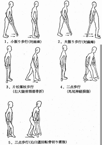 過去問題 理学療法士国家試験 作業療法士 国家試験対策 Webで合格