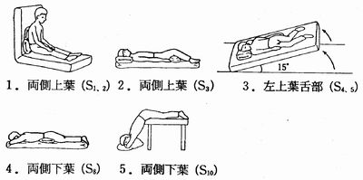 ドレナージ 体位